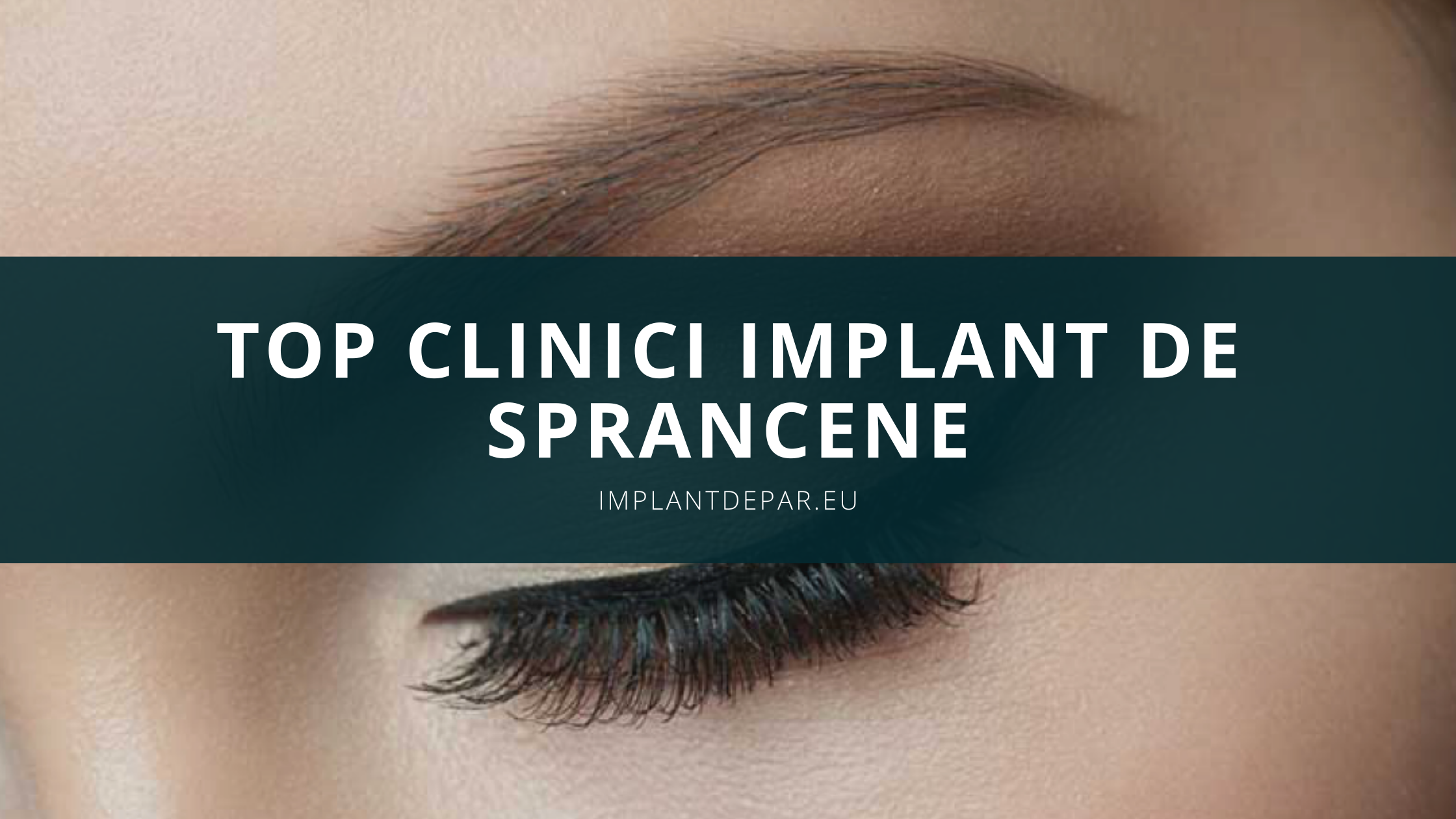 Implant de sprancene – Top clinici Implant Sprancene in 2022